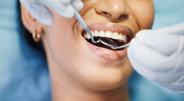 Best Emergency Wisdom Teeth Removal in Jasmine Estates, FL